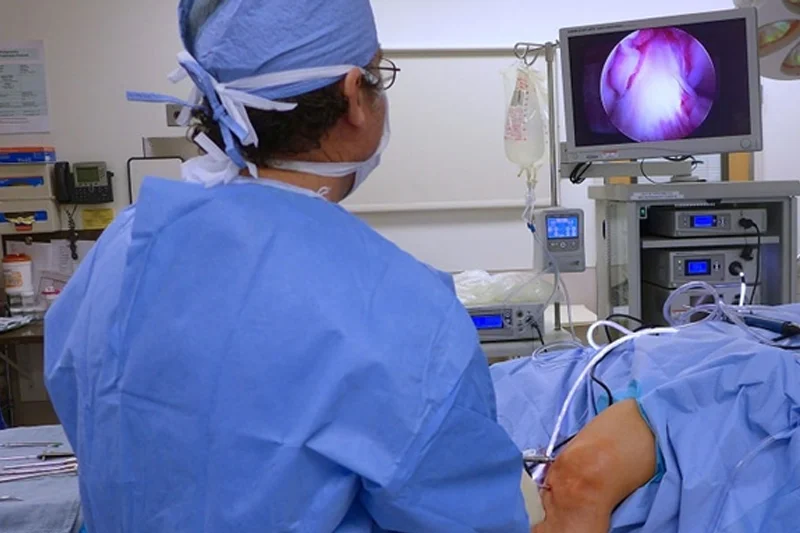 arthroscopy