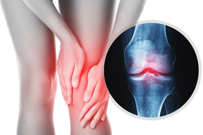 meniscus-tear